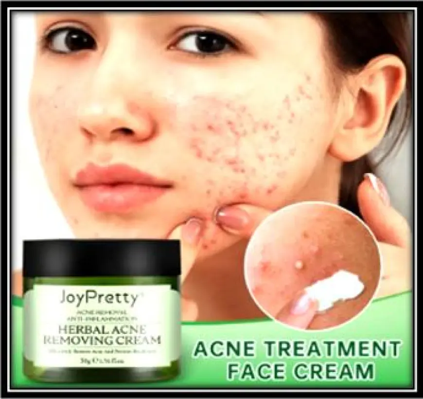 Can health care cream help with acne and blemishes?