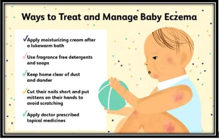 How to Manage Baby Eczema and Other Common Skin Issues