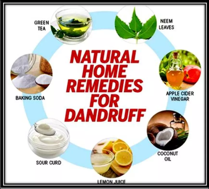 What Are the Best Natural Remedies for Dandruff Control?